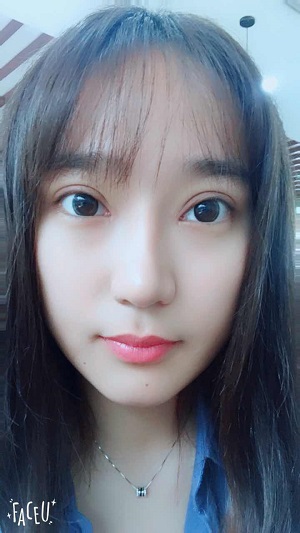 <b>杭州格莱美医疗美容医院陈笑双眼皮+开眼角</b>